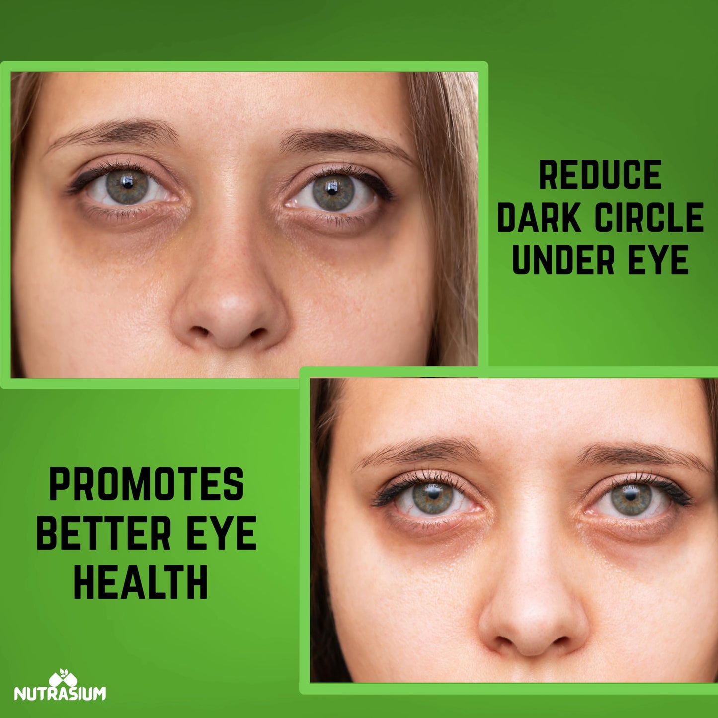 Nutrasium Eye Care | Lutein, Zeaxanthin Astaxanthin Eye Supplement | Supports Healthy Vision, Helps Reduce Digital Eye Strain & Fatigue from High Screen Time for Men, Women & Students